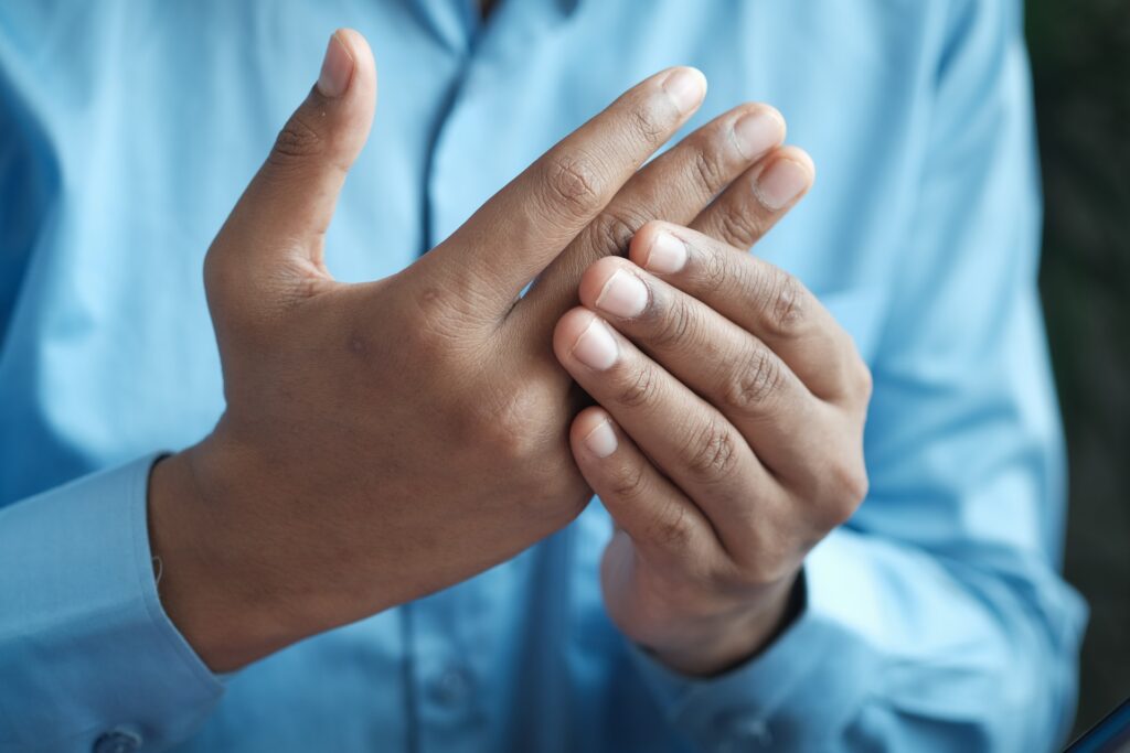 a man massaging his hands due to pain from psoriatic arthritis